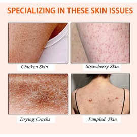 Trendyfave Turmeric Body Lotion, Body Moisturiser With Turmeric And Vitamin C, Remove Dark Spots, Moisturizing Body Lotion for Dry Skin, Body Skin Care Smooth Skin, Large-capacity 200ml