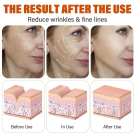 Super Vitamin C Serum for Face Wrinkle & Age Spots Reduction All-In-One Hydrating