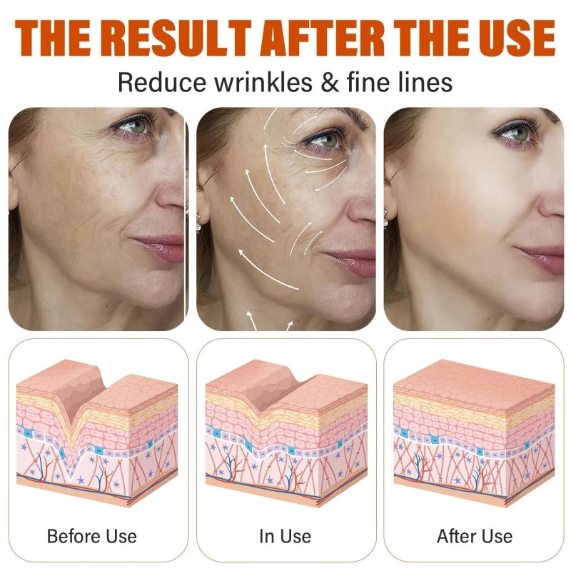 Super Vitamin C Serum for Face Wrinkle & Age Spots
