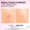 Crema Día Anti-manchas Con Ácido Glicólico L'oréal Paris Todo tipo