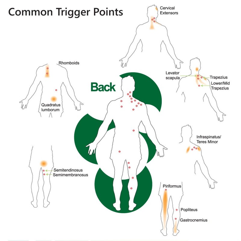 LOCKEROOM Pocket Physio Muscle Trigger Triangle, Pressure Point Release, Relieve