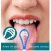 Cepillo De Dientes Blando, Kits De Ortodoncia Para Dientes D
