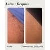 Topicals High Roller Ingrown Hair Tonic with Salicylic Acid, AHAs