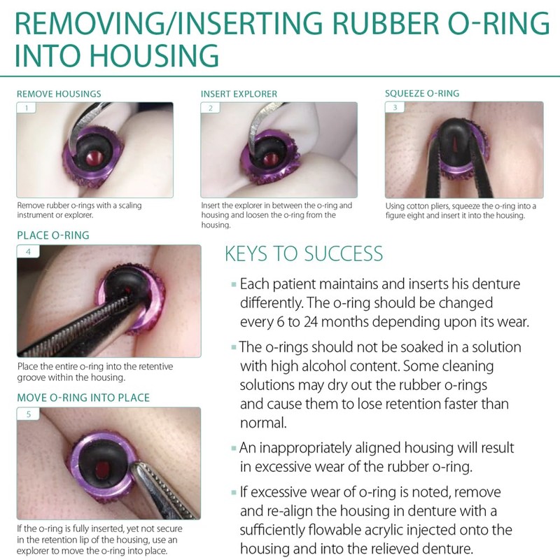 MDLMOR10Z MDLORZ Replacement O Ring Kit, for Intralock Mini Implant