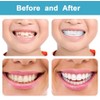 Denture Teeth Temporary Fake Teeth Snap On Top and Bottom
