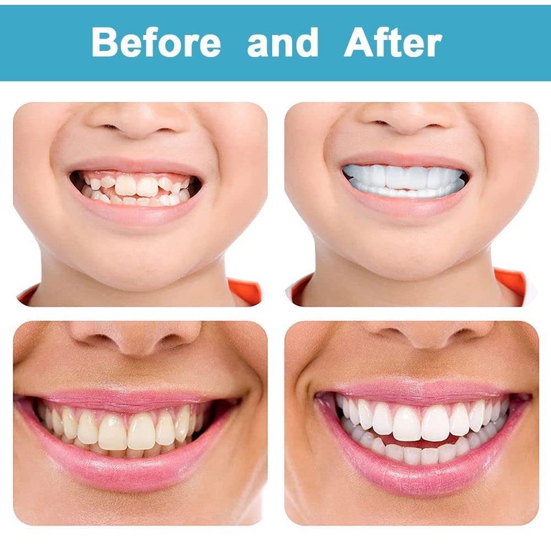 Denture Teeth Temporary Fake Teeth Snap On Top and Bottom
