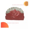Den Med Modelo Dental Gingivitis