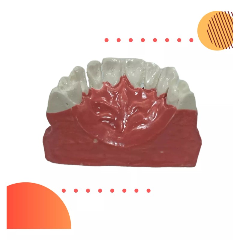 Den Med Modelo Dental Gingivitis