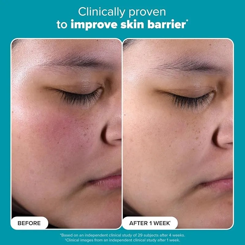 Exfoliante Facial Con Ácido Salicílico Para Poros Dilatados