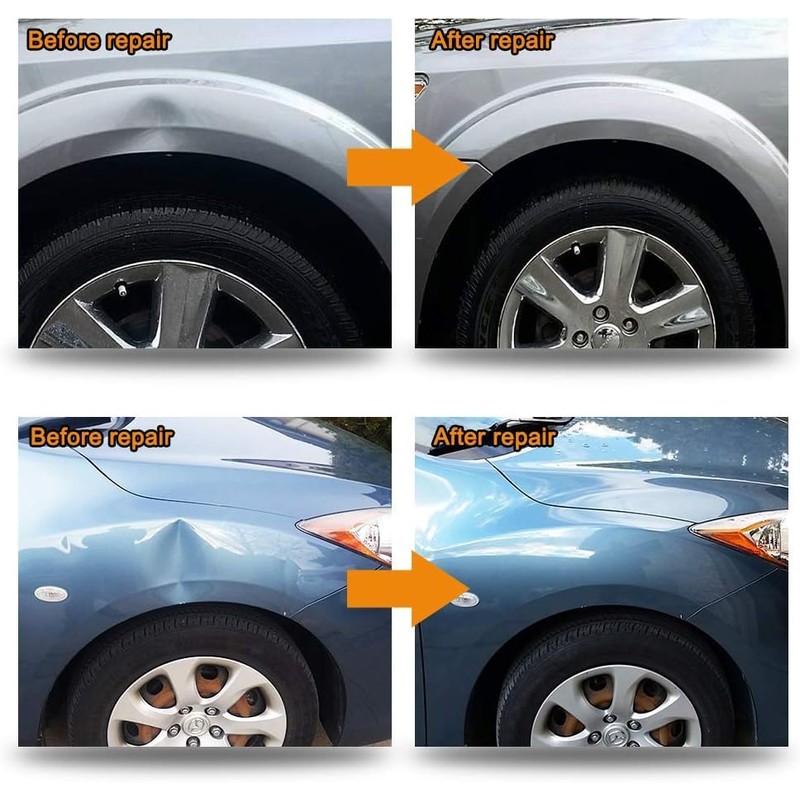 Manelord Auto Dent Puller Set with Double Pole Bridge Dent