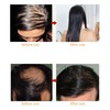 Laser Hair Growth Comb Anti Hair Loss Massager Hair Regrowth
