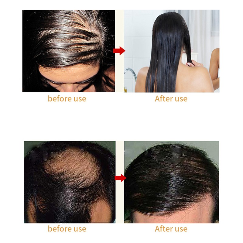 Laser Hair Growth Comb Anti Hair Loss Massager Hair Regrowth