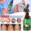JAYSUING Ginger Nail Care Liquid, Nail Nutrients, Repairs Damaged and