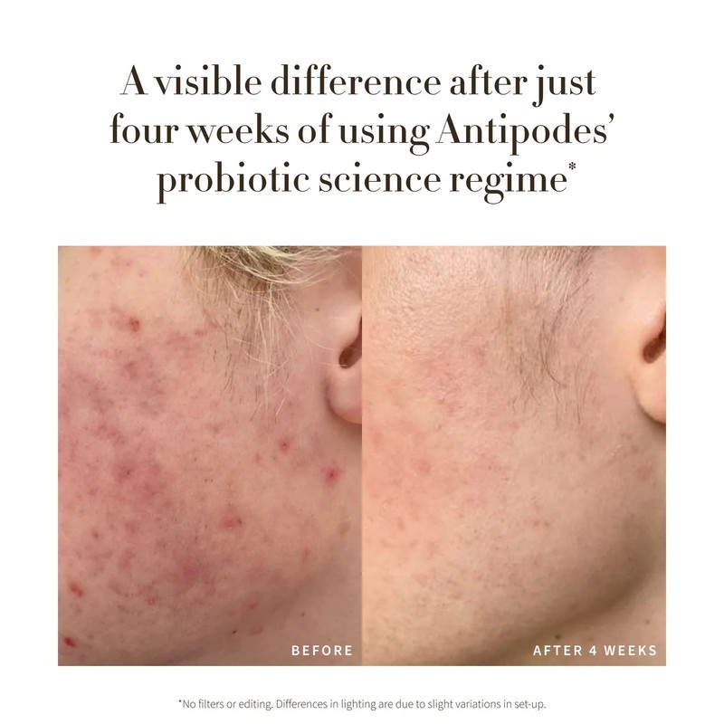 Antipodes Credo Probiotic Anti-Blemish Serum 30ml