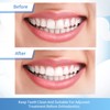 Dental Polishing Strips, Teeth Abrasive & Finishing Strips 4mm x