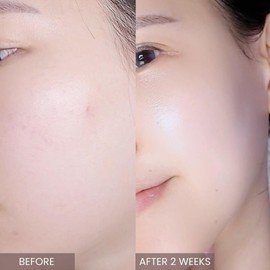 [APLIN] Pink Tea Tree Toner 150ml Pink teatree toner Toner Wipe-off toner Moisturizing Sensitive skin Oily skin Skin care Korean cosmetics