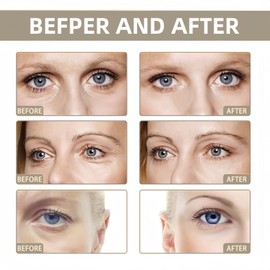 Caffeine Eye Serum,Eye Serum for Dark Circles and Puffiness,Hyaluronic Acid under E/ye Cream,E/ye Cream with 360。Ey/e Roller Massage Ball,Ey/e C/ream Anti Aging,E-ye S/erum,E-ye C/ream for Wrinkles