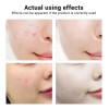 Bioaqua Serum Oro 24k Rejuvenecedor Acido Hialuronico