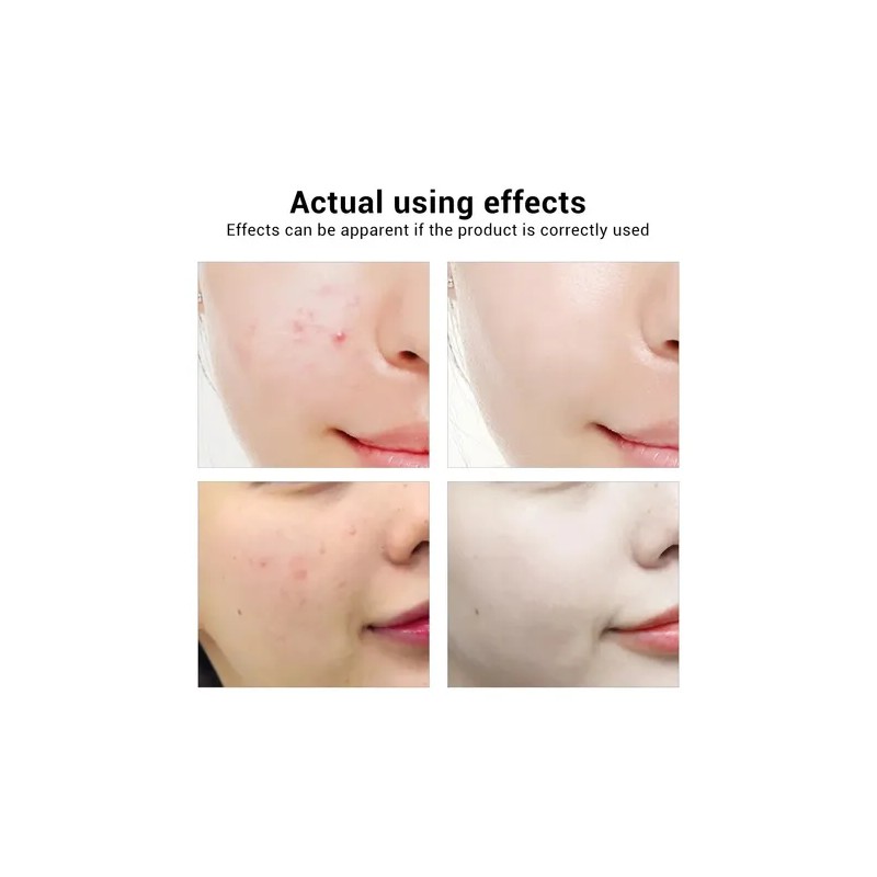 Bioaqua Serum Oro 24k Rejuvenecedor Acido Hialuronico