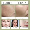 Mascarilla Facial Limpiadora De Aguacate Con Ácido Complejo