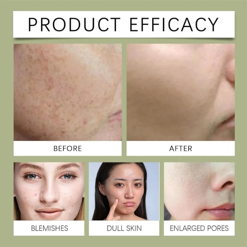 Mascarilla Facial Limpiadora De Aguacate Con Ácido Complejo
