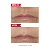 Dermelect Smooth Upper Lip & Perioral Anti-Aging Treatment - Professional