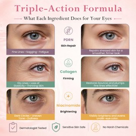 5000ppm PDRN Under Eye Patches - Salmon DNA Collagen Eye Mask, 60 Ct
