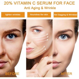 20% Vitamin C Serum for Face with Hyaluronic Acid Serum, Antioxidant, Fades Dark Spot, Boost Skin Collagen, Plump Skin 30ML