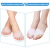 DOACT 3-Hole Bunion Corrector Protector with 5-Hole Big Toe Straighteners,