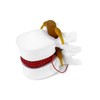 QWORK Anatomical Human Lumbar Vertebrae Degenerative Spine Model - for