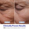 Dr. Denese SkinScience HydroShield Retinol Serum for Face 0.5oz Travel