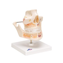 3B Scientific VE281 Adult Denture - 3B Smart Anatomy
