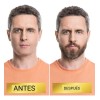 Suero Para Barba Hidratación, Cuidado Vello Facial + Rodillo