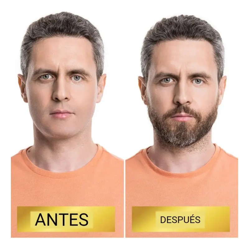 Suero Para Barba Hidratación, Cuidado Vello Facial + Rodillo