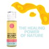 Base Labs Piercing Bump & Keloid Bump Removal Solution |