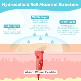 Hydrocolloid Wound Dressing Roll 2in x 16ft – Cut-to-Size Self-Adhesive Hydrocolloid Bandage, Flexible Waterproof Skin Cover, First Aid Supply, 11.8mil Thickness