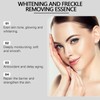Whitening and Freckle Removal
