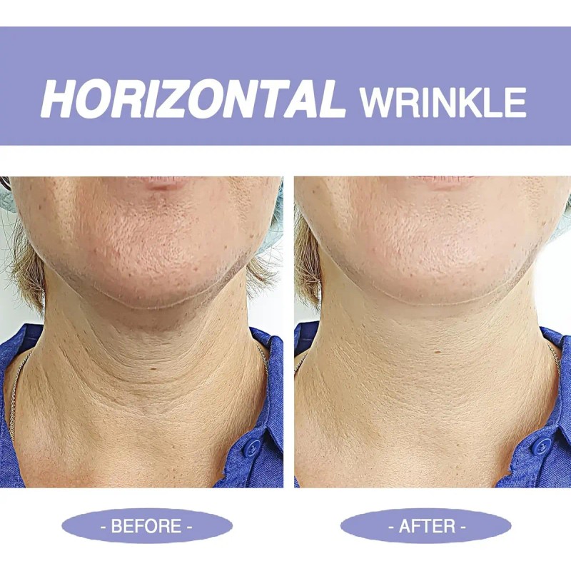 Crema Reafirmante Para El Cuello Y La Clavícula,colageno