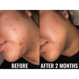 Serum Good Molecules Discoloration Correcting Para Todo Tipo
