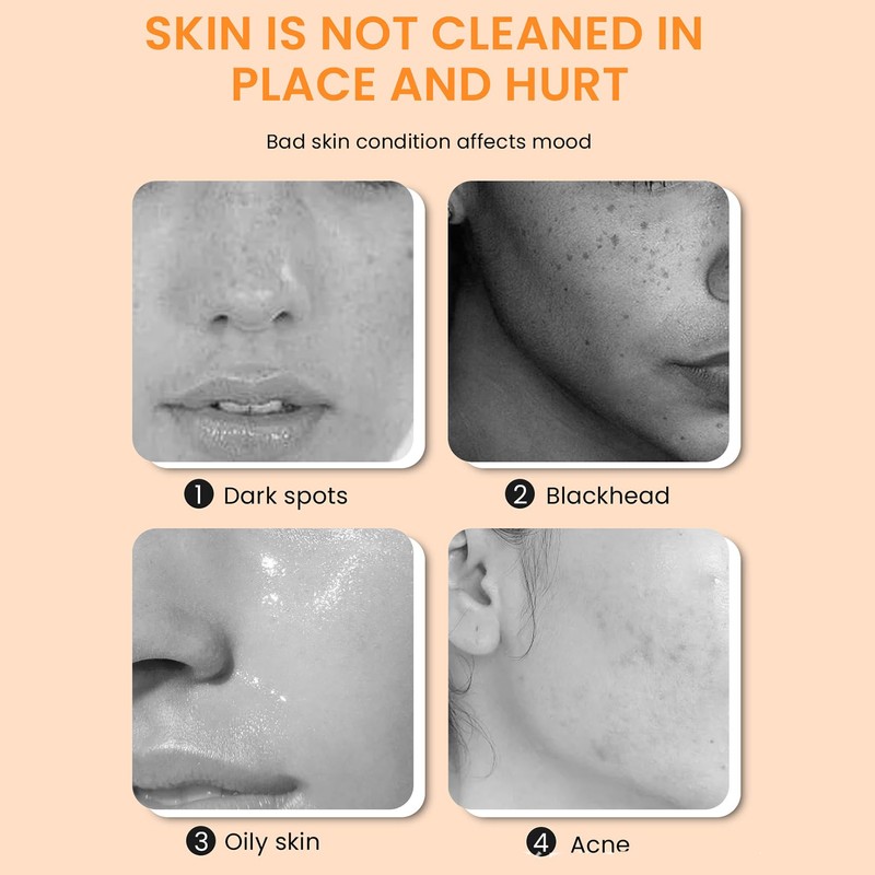 MEITREND -Turmeric Kojic Acid Soap for Dark Stains