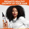 Brzeaf- 【Promueve el crecimiento del cabello】El aceite para cabello Chebe