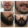 Crecer La Barba Bigote Cejas Profesional Y Natural Novocrin