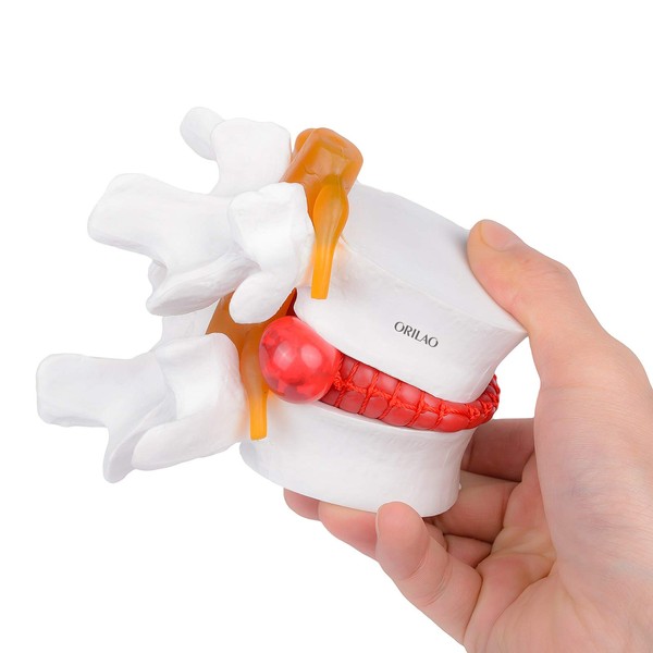 ORILAO Anatomical Lumbar Spine Model 1:1.5 White for Study and