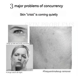 QINGLIN Anti-wrinkle and anti-aging cream 50g | peptide + sodium hyaluronate | Smoothes wrinkles, tightens skin, 24-hour moisturizing, non-greasy - Specification: not recommend【1 bottle】