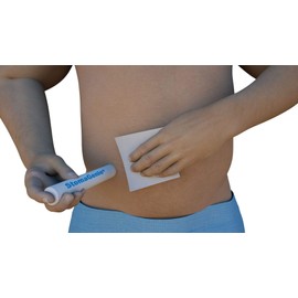 STOMAGENIE Stoma Waste Capture Device - 10-Pack (1 1/8"), Disposable Stoma Capture Cartridge for Any Type of Ileostomy, Urostomy, Colostomy Stoma Pouch Change, Skin Protection, and Leakage Prevention…