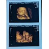 Prank 3D COLOR Customized Fake Ultrasound Strip of 2 Photos