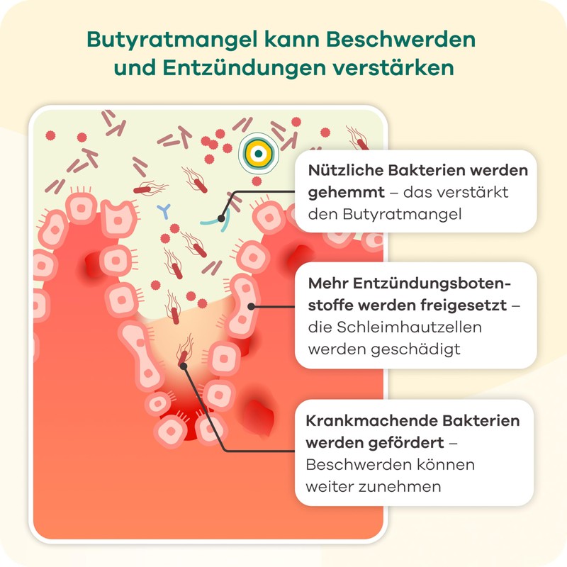 Butyzole - Diet Management for Irritable Bowel Dietra, Diverticula &