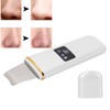 Skin Scrubber Spatula Ultrasonic Blackhead Comedones Removal Device Facial Scrubber