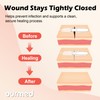 Ourmed Wound Closure Strips(2.4"x 2.8" - 4 Pcs), Butterfly Bandages