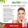 Crema Anti Acne con 9 extractos de flores, plantas y